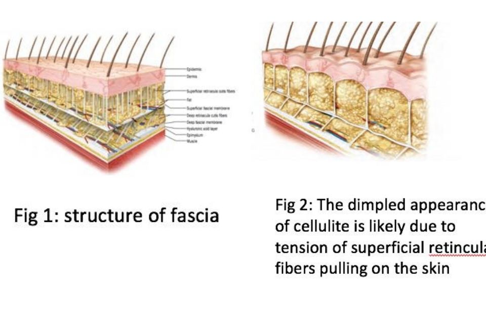 fascia - esha case study